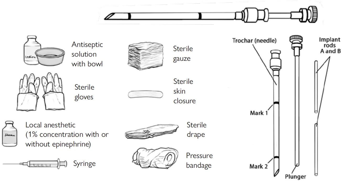 Inserting Implants Family Planning